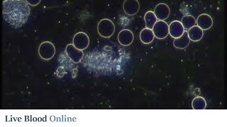 Platelets - Live Blood Analysis Training Course