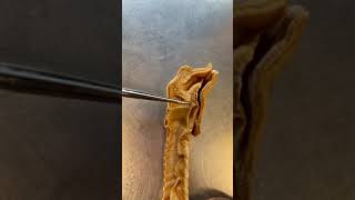 This Is A Real Human Vocal Cord