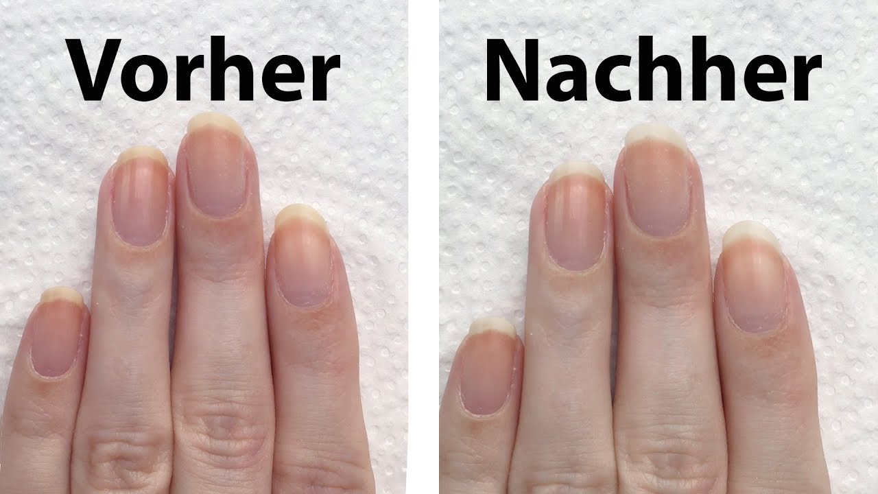 Miliz Fälschung Hass nagelverfärbung durch nagellack Kleiderschrank ...