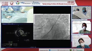 “Stenting Technique For Patiens With Bifurcation Coronary Artery Desease”