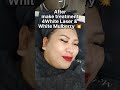 Hilangkan Jerawat Selama 6 Tahun Sebab 4Langkah 4White LaserTM + White Mulberry Skin Booster.