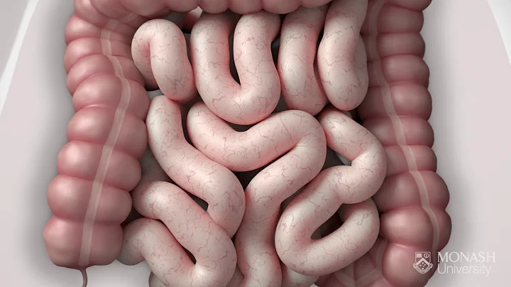 IBS Symptom relief using the FODMAP diet & Monash FODMAP app