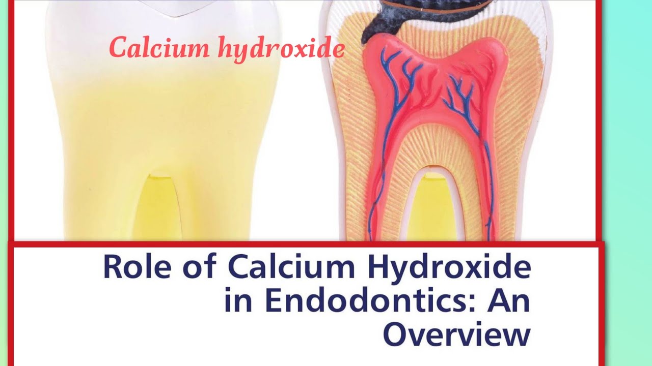 Role of calcium hydroxide. pulp capping agent. Intra canal medication ...