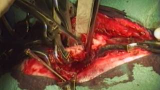 Dr.ペローの 『 整形外科手術テクニック 』 ～ イヌの大腿骨骨折の内固定法 ～