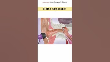 Noise Exposure | 3D animation