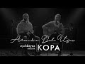 Kopa Armudun Dal脹 Uzun SiyahBeyaz Akustik Kopa Armudun Dal脹 Uzun SiyahBeyaz Akustik