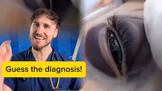 A boy with black eyes?! | Guess the diagnosis