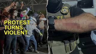 ICE Protest Meltdown: Agents Bitten, Chaos Erupts