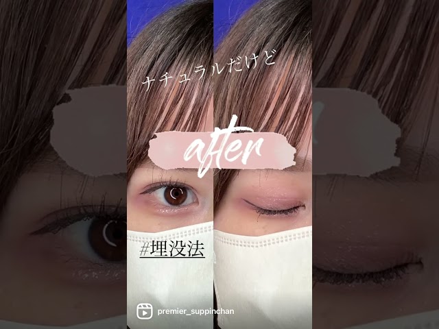 ゼオスキン】ハイドラファームとGファクターアイセラムの使い方と解説 ...