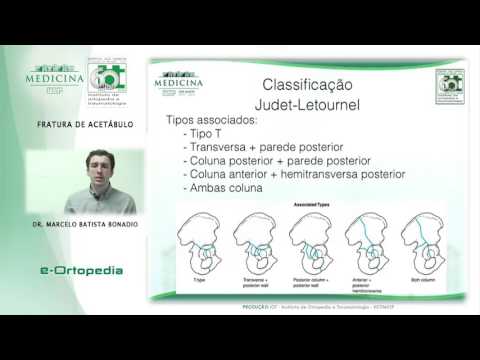 Vídeo: O que é uma fratura acetabular?