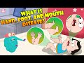 What is hand foot and mouth disease  infection in children  the dr binocs show  peekaboo kidz