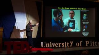 The BIG reach to map the circuit diagram of the mind | Walter Schneider | TEDxUniversityofPittsburgh