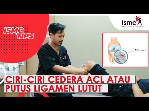 Video: Cara Membuka Lutut Anda: 12 Langkah (dengan Gambar)