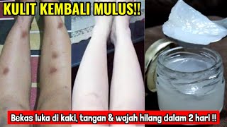 HOW TO REMOVE SCARS ON YOUR FEET, HANDS, AND FACE (SCABGs) QUICKLY AND NATURALLY | 100% EFFECTIVE!!