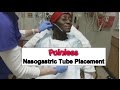 Painless Nasogastric Tube Placement