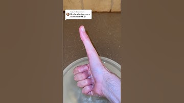 Longest Thumb on Earth