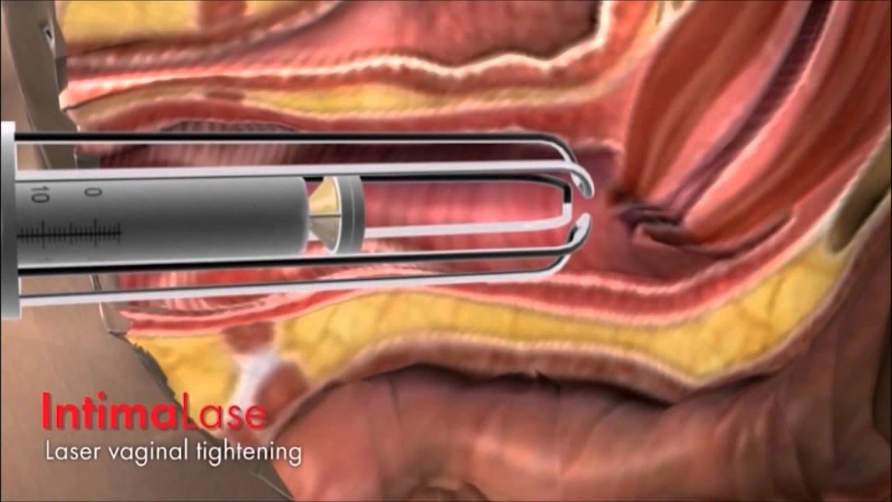 Rus osmir qizlar bilan porno Ogil ona jinsiy aloqa va cums fucks va u homilador boladi