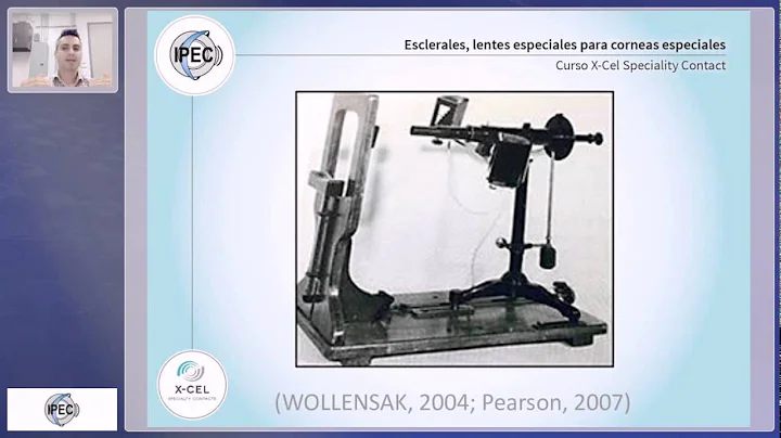 Lentes Esclerales tricos. Dr Edward Carmona