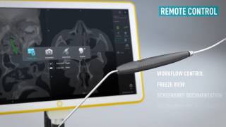 Kick® EM for ENT—Electromagnetic Navigation for Sinus Surgery