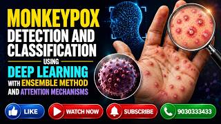 Monkeypox Detection & Classification Using Deep Learning | Final Year CSE Academic Project 2026