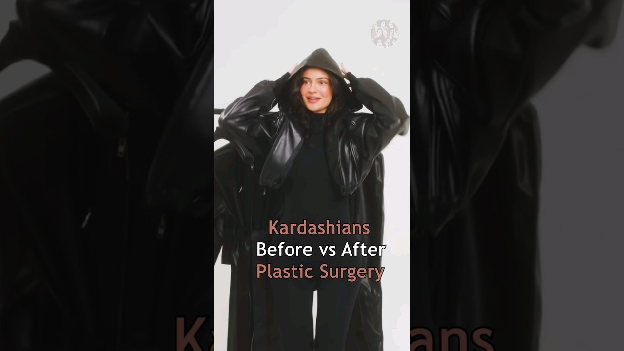 Kardashians Before vs After Plastic Surgery