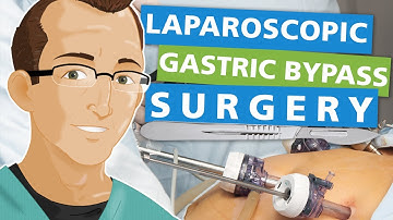 Laparoscopic Gastric Bypass Surgery