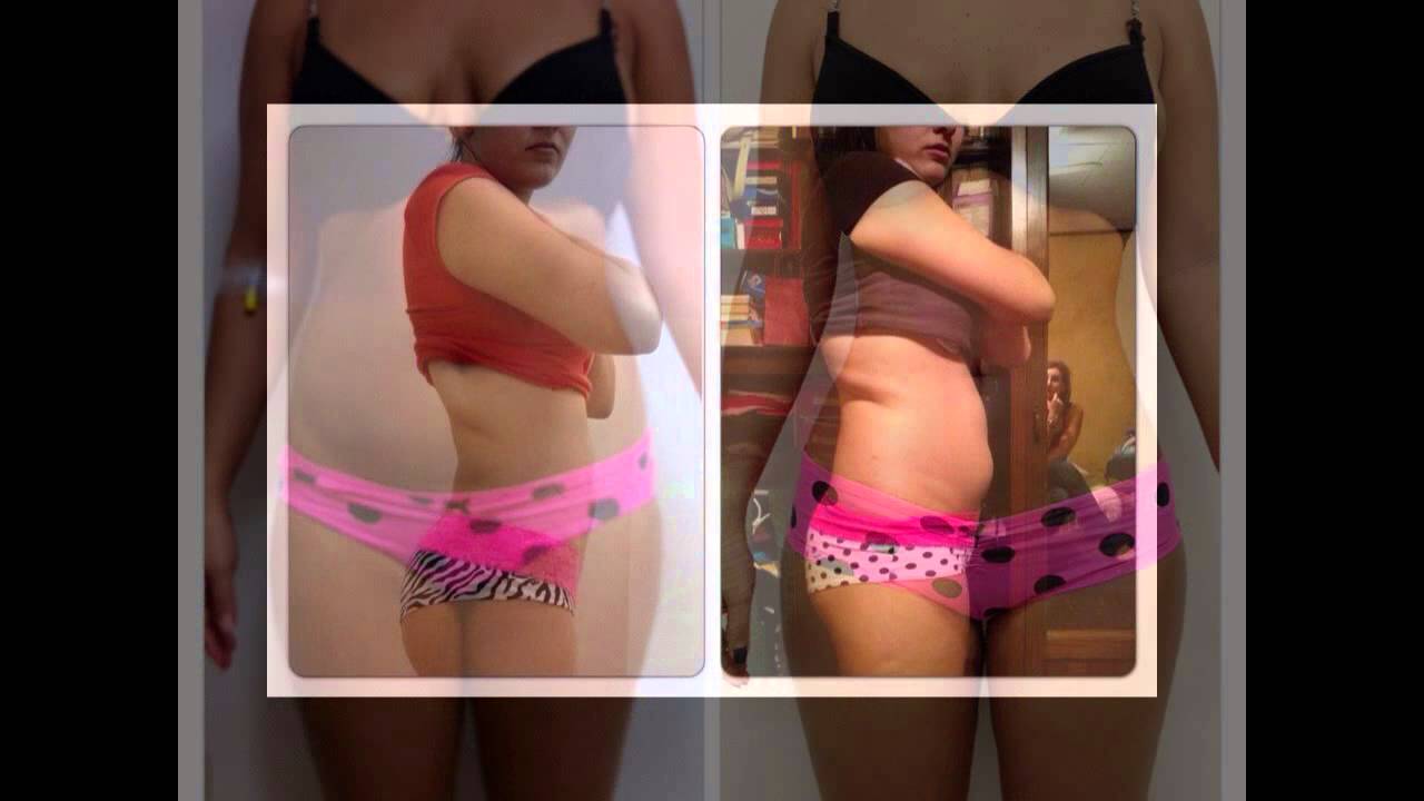 Slim Laser En Mujeres Youtube