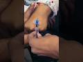 vigo Kaise lagaen #youtubeshorts #usa nursing practice #reels #trendingshorts #usa #trending #viral