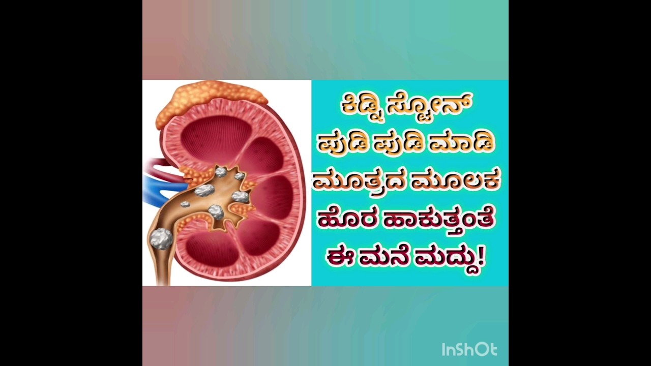 #kidney