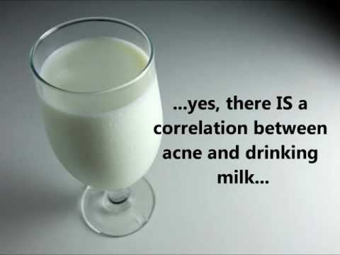 Does milk cause acne? Myth or reality ? Does milk cause acne : the answer