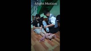 First aid kit using ANATOMICAL SPLINT