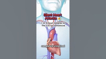 Are You Missing These Silent Heart Attack Signs?