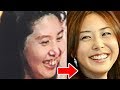 【衝撃】実は入れ歯だった意外な芸能人達がやばかった・・！