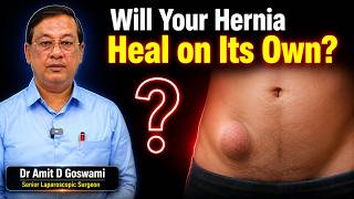 Can a Hernia Heal Without Surgery l Dr Amit D Goswami
