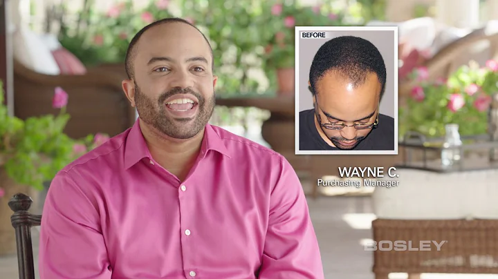 Bosley Hair Transplant Patient Review - Wayne C.