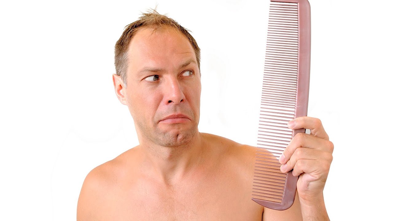 What Causes Alopecia Thinning Hair Youtube