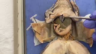 Frog Dissection Part Ii