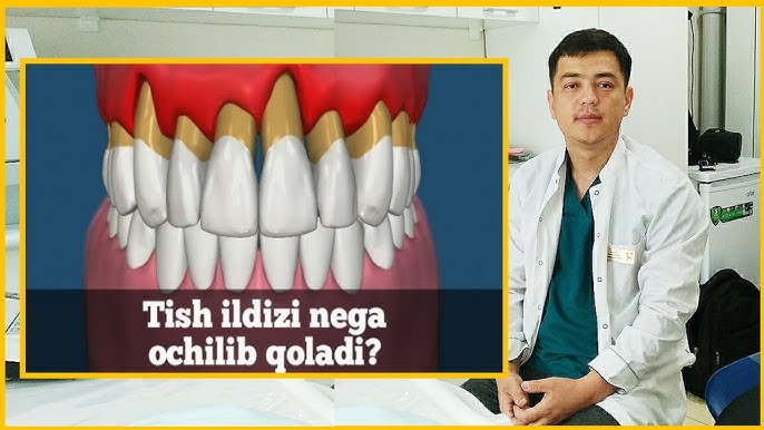 Gozal qoramagiz profil rasmi Ormonda tasodifiy etekdagi porno fotosuratlar