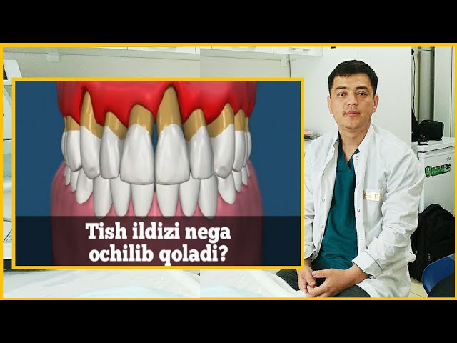 Temirchi qizlari jinsiy aloqa