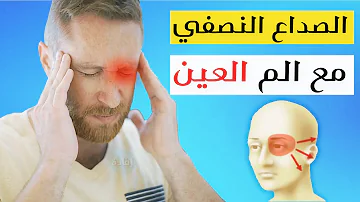 أماكن الصداع