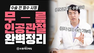 무릎 인공관절 수술 전, 필수 영상! 정형외과 전문의가 궁금증을 해결해 드립니다