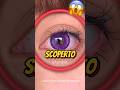 QUESTA SINDROME È ASSURDA MA...😱 #curiosità #informative