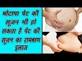 मोटापा पेट की सूजन भी हो सकता है पेट की सूजन का रामबाण इलाज Ways of treating bloating