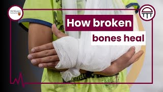 How Broken Bones Heal?