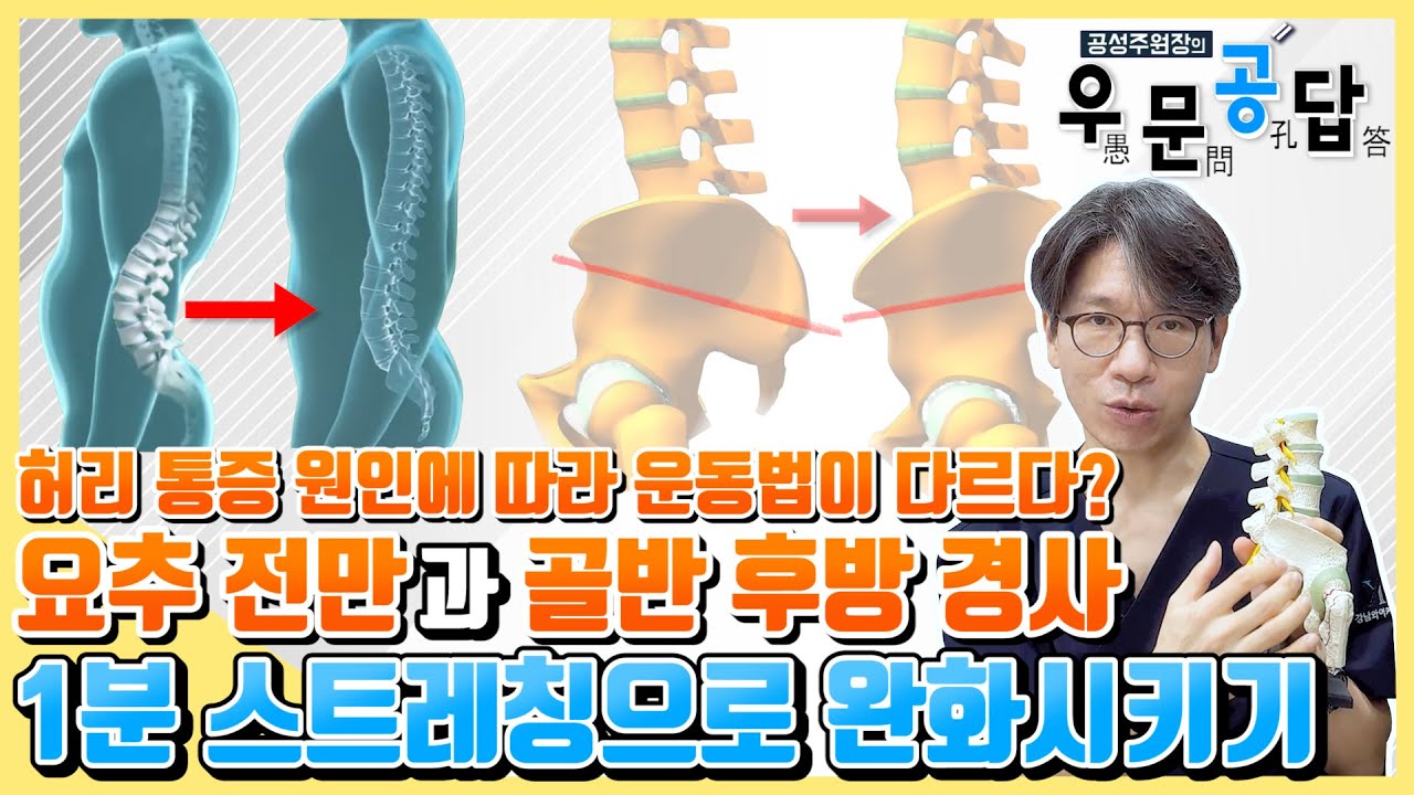 [우문공답] 요추 전만과 골반 후방 경사, 허리 통증 원인에 따라 운동법이 다르다? 1분 스트레칭으로 완화시키기 - YouTube