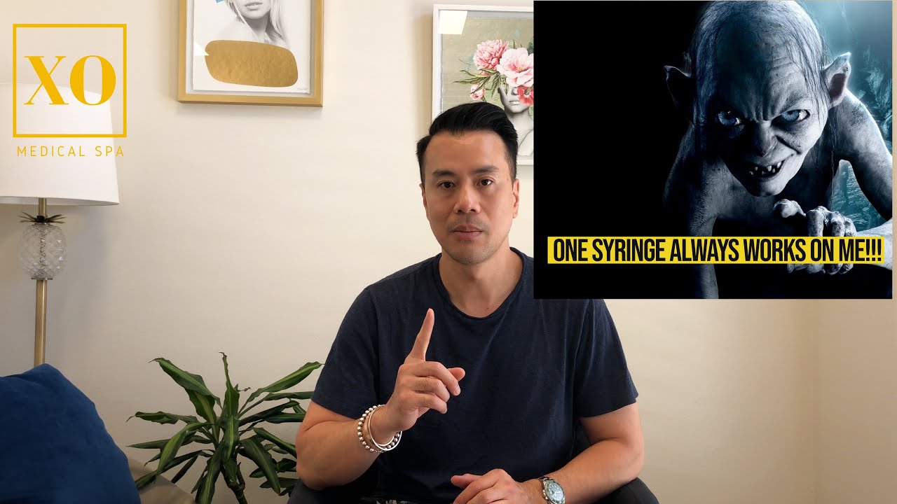 XO Medical Spa // How many syringes of filler do I need?