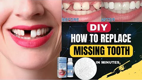 DIY How to Replace Missing Tooth in Minutes