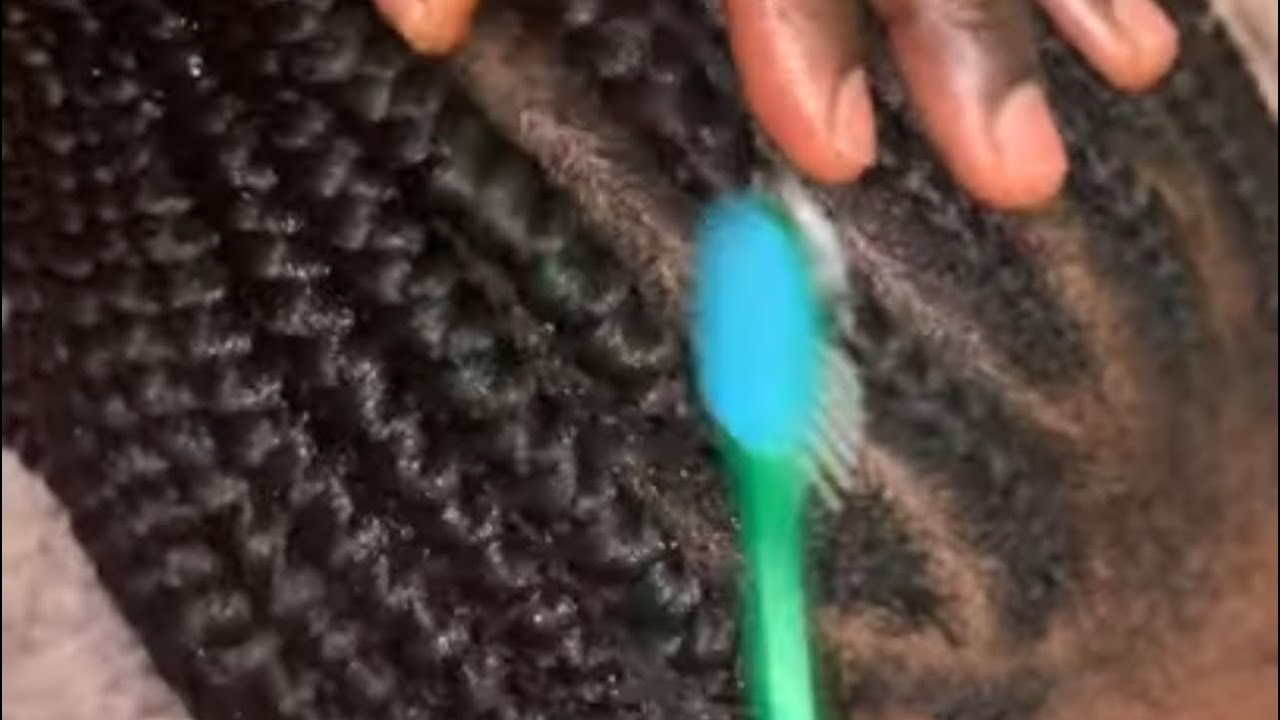 ASMR extreme scratching of dandruff and greasing hair & scalp| tingle