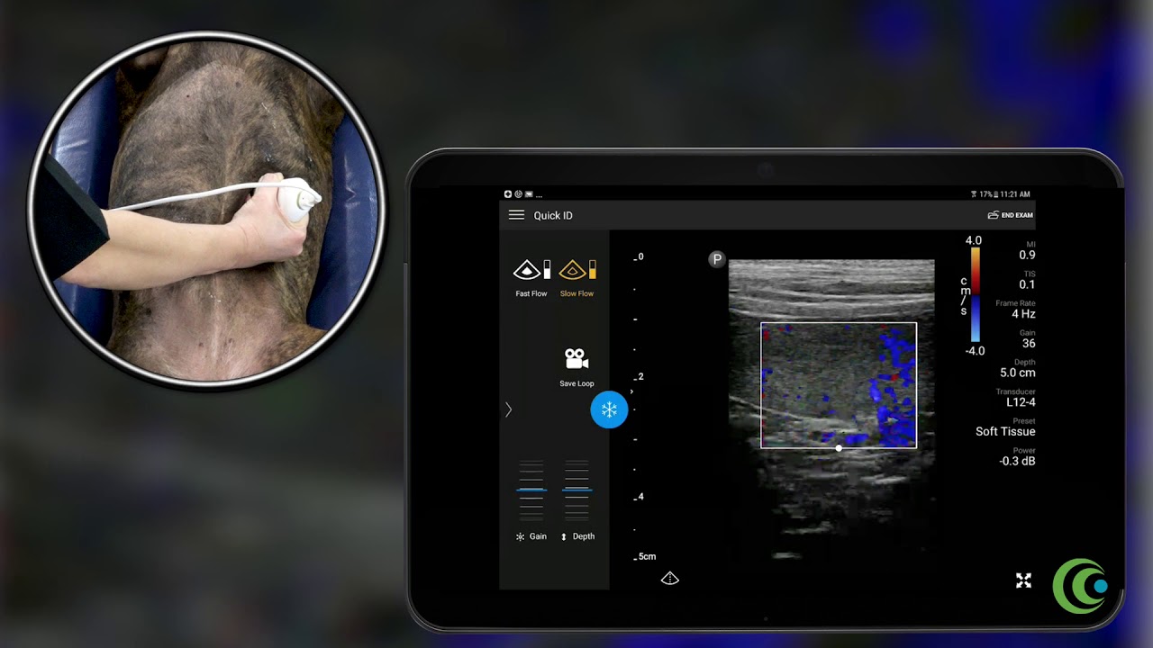 Utilizing Color Doppler with the Philips Linear Lumify YouTube