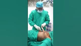 Gynecomastia Surgery Massive Gland Removal #shorts